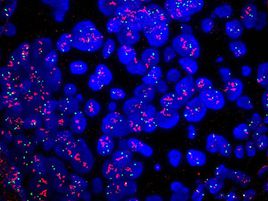 فرم رضایت نامه و اطلاعات  FISH